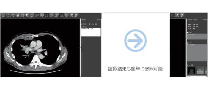 処置入力も会計も、誰もが使いやすい操作性