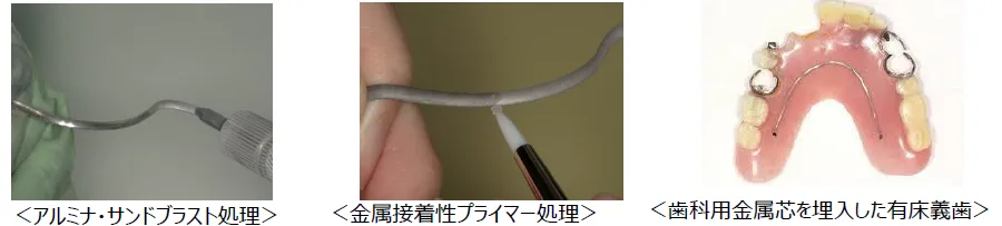 歯科技工士の技術の評価